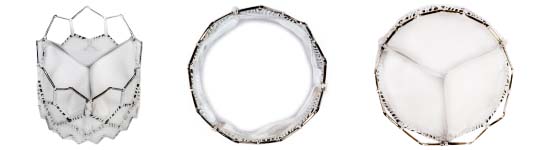 Heart valve prosthesis 