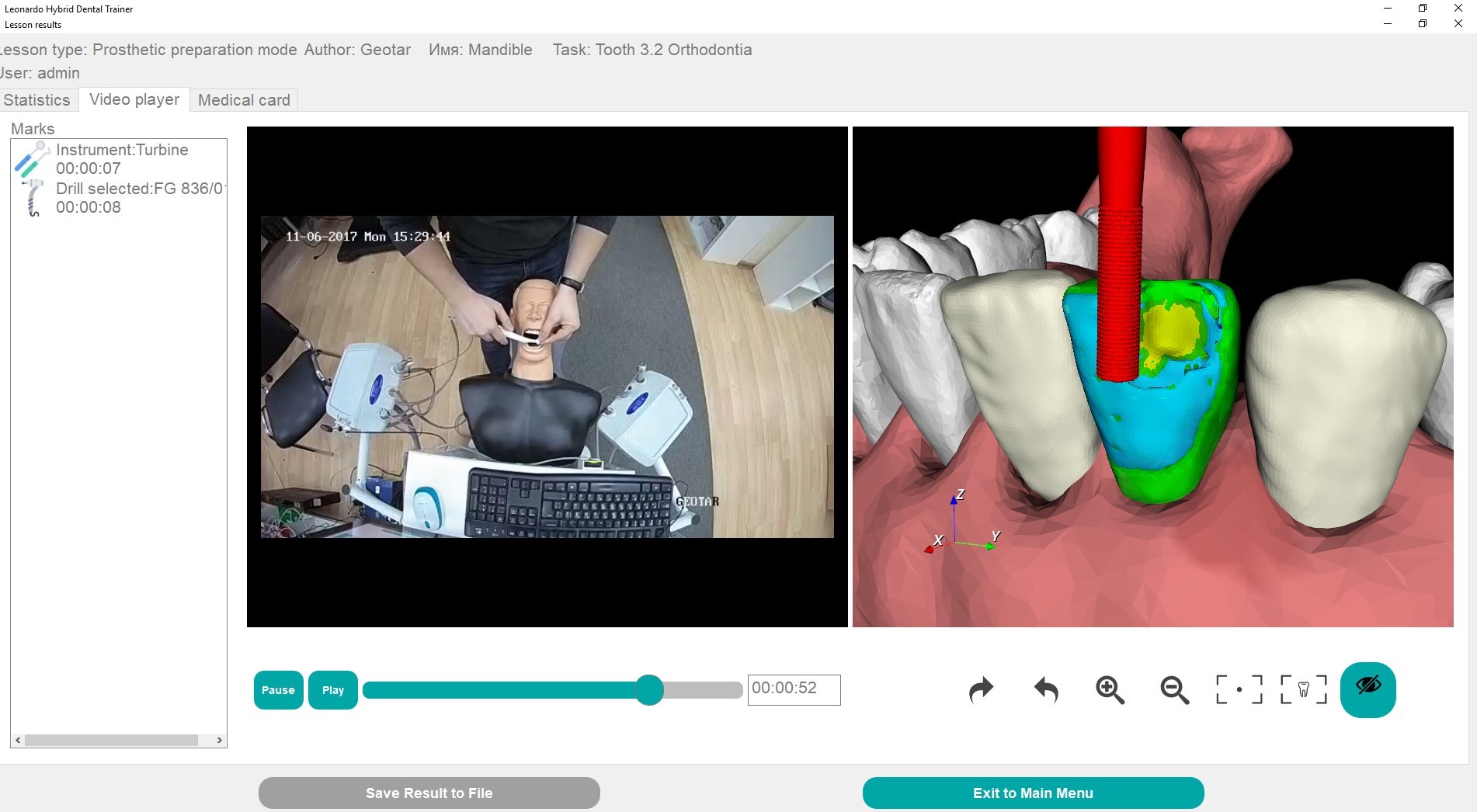 Hybrid virtual dental simulator «LEONARDO»