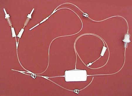 THE SYSTEM OF NON-APPARATUS MEMBRANE PLASMAPHERESIS HANDLED WITH A SYRINGE UBM-01-