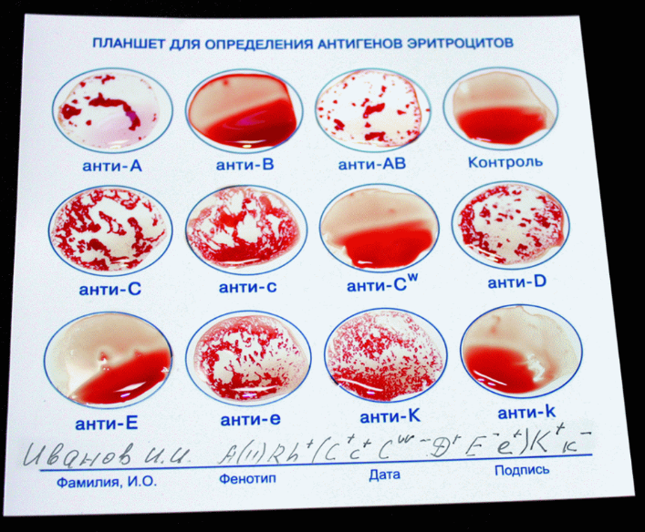 Карточка-планшет для фенотипирования крови 