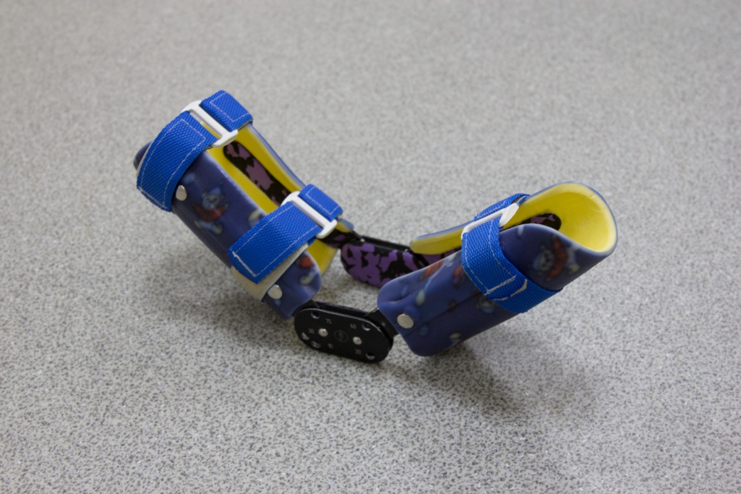 Ортезы верхних конечностей