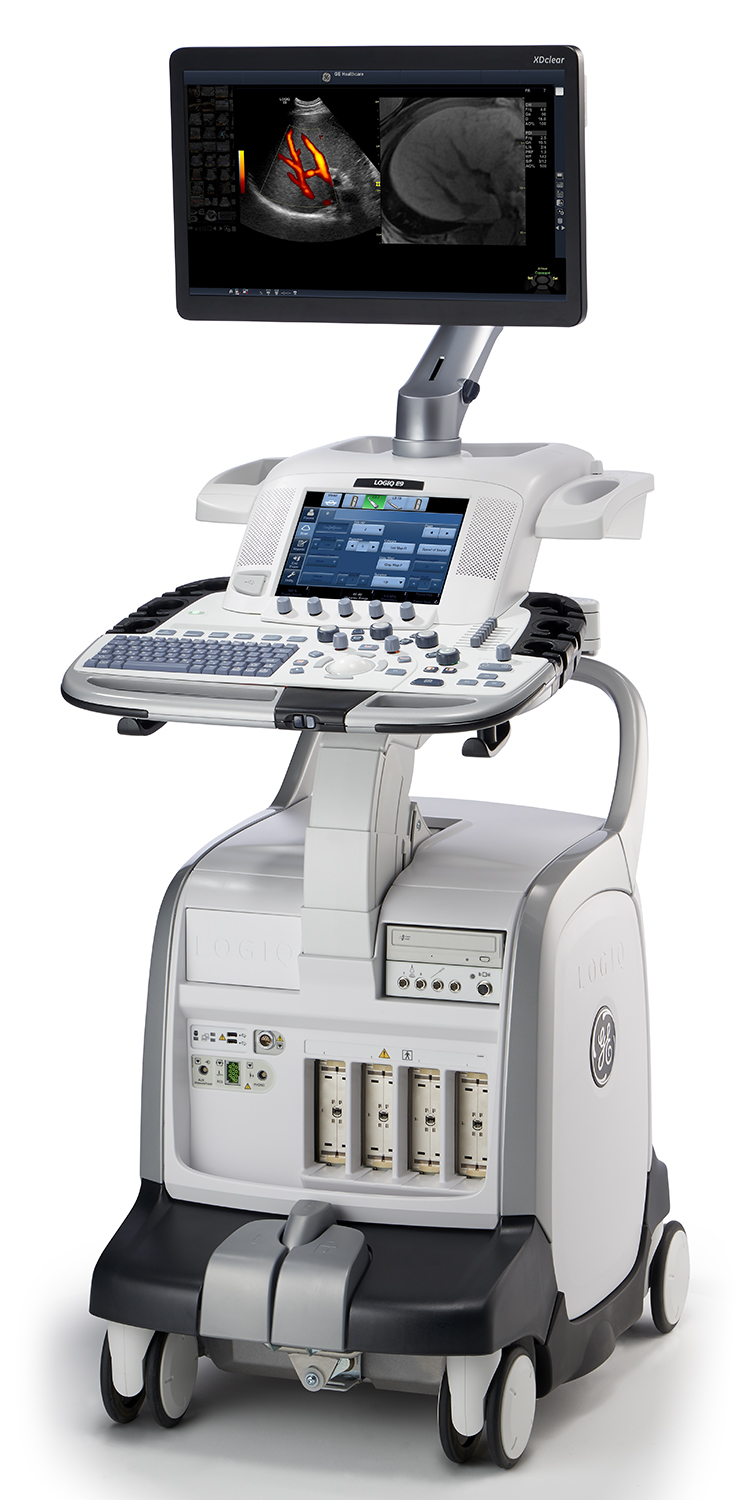 Diagnostic ultrasound system Logiq E9 2XDclear 2.0