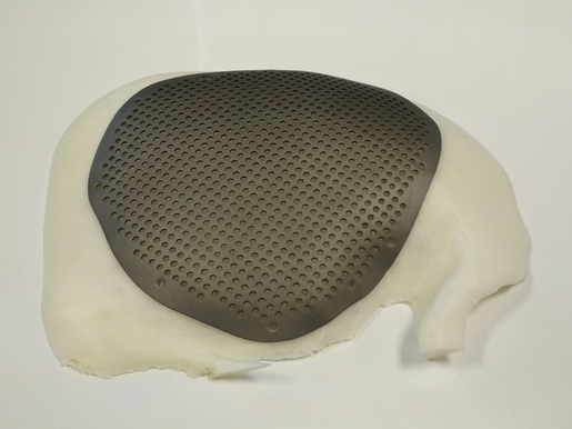 Индивидуальные краниопластины