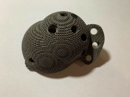 Индивидуальные тазобедренные чашки